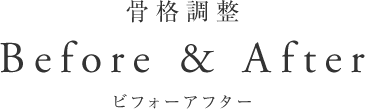 骨格調整ビフォーアフター