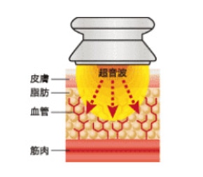 気泡が発生する様子