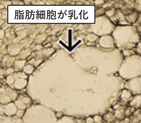 脂肪細胞が乳化する様子