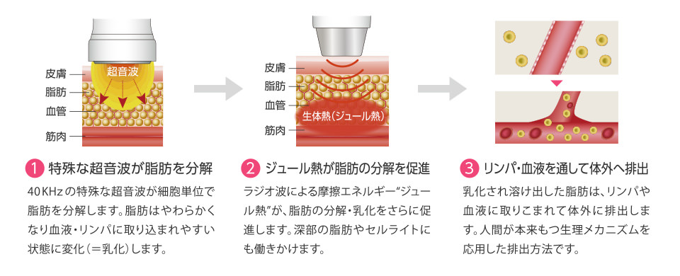 脂肪を取りのぞくメカニズムイメージ